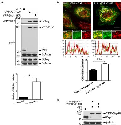 SENP3 Promotes an Mff-Primed Bcl-xL-Drp1 Interaction Involved in Cell Death Following Ischemia